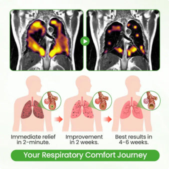 💖🫁🇺🇸✅Official Store: CareBreeze® Botanical Mullein Lung Cleanse Diffuser（👨‍⚕️Directly acts on COPD, asthma, chronic bronchitis (CB), respiratory infections, lung cancer, sinusitis, and other conditions）