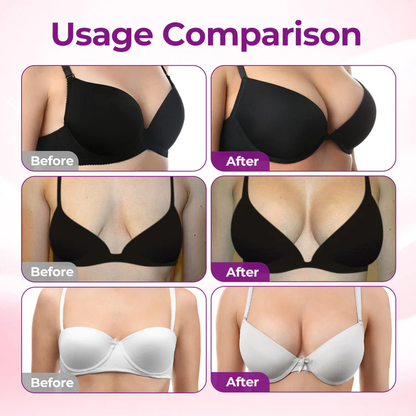 💥Turonu® 🖤 Targeted Breast Enhancement Advanced Nano Microneedle Patch💃