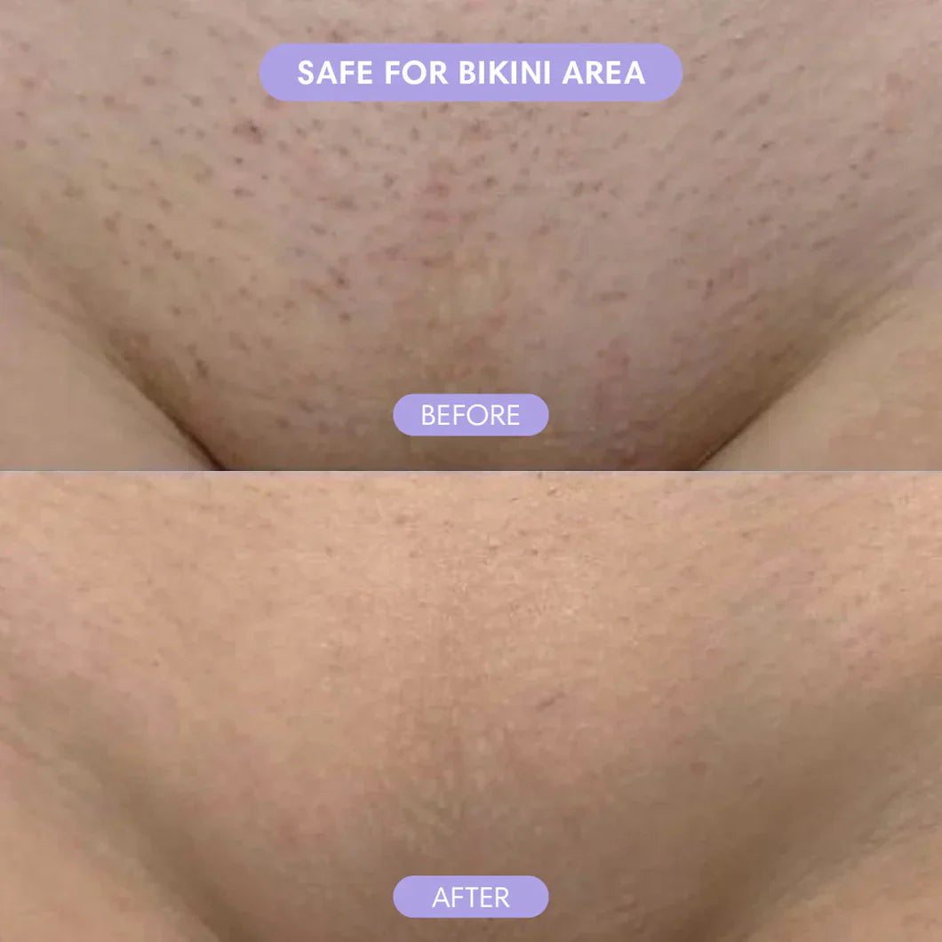 Smoothé — Body Hair Removal Spray